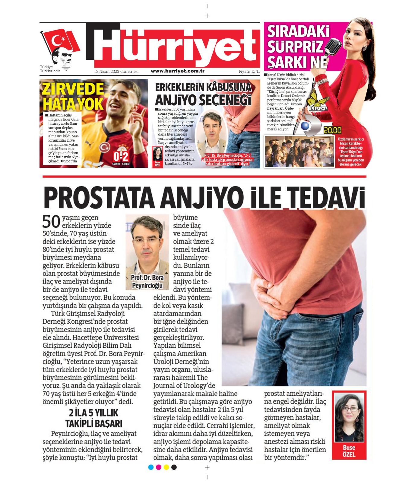 PROSTATA ANJİYO İLE TEDAVİ